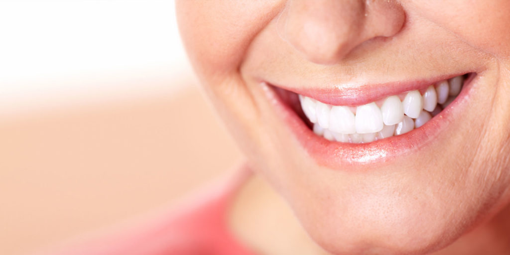 dental patient smiling after implants procedure